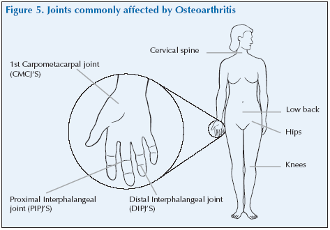 Fig 5